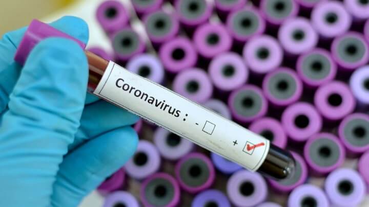 Πνευμονολόγος: Οι 8 «εντολές» για τον κορωνοϊό
